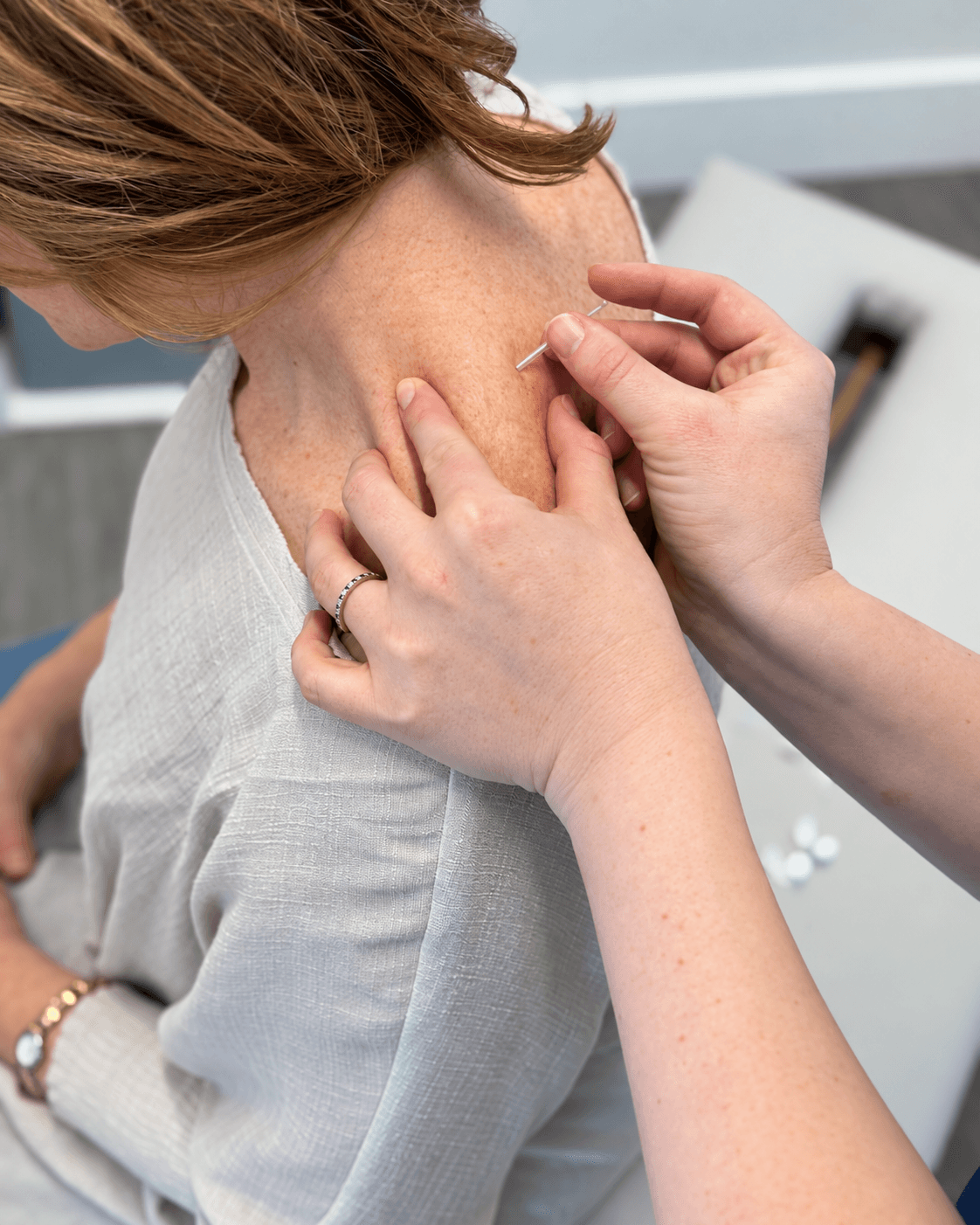 A fine dry needling needle applied to a muscle near the shoulder