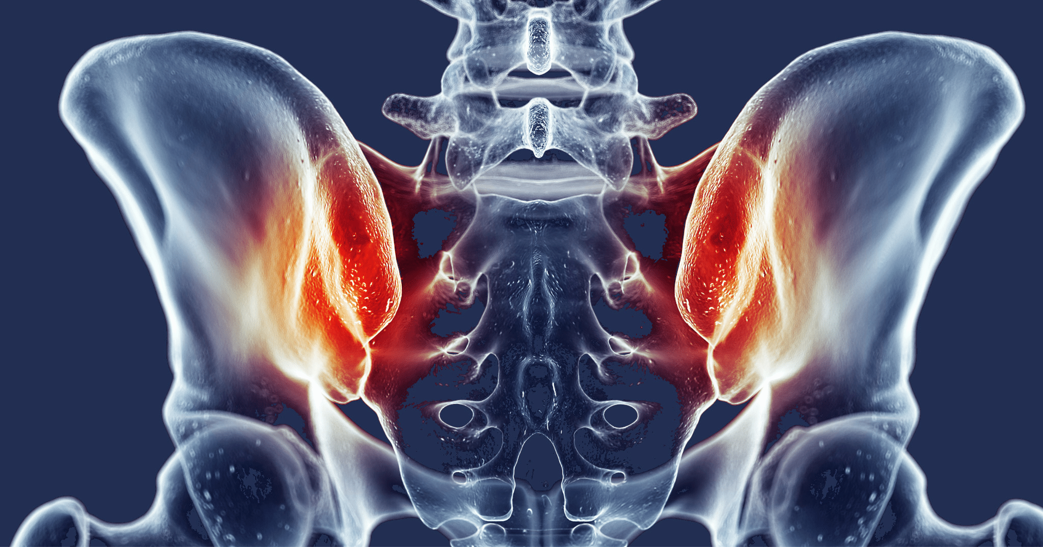 Sacroiliac Joint (SI Joint Pain): Causes & Natural Treatments - Well Health Centers